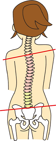 体の歪み